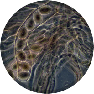 子囊孢子